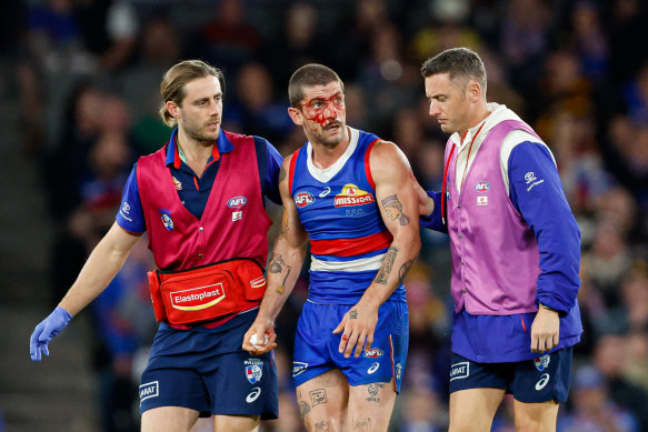 Liberatore was ruled out of the game with concussion in the dying minutes of the match against Hawthorn.