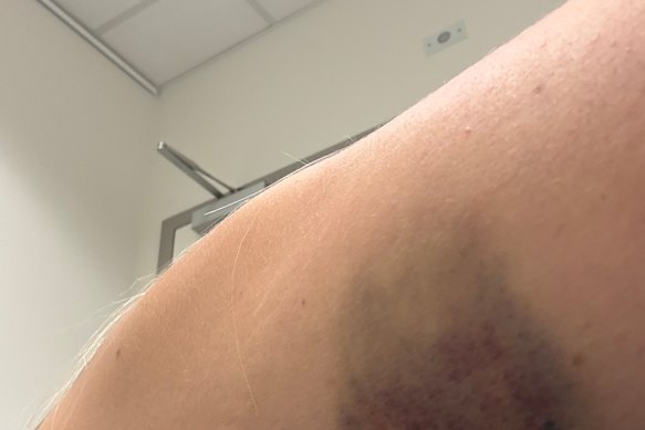 Which way on a two-street caused this?