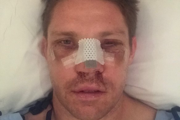 Chris Lawrence after waking up from surgery almost two weeks after he was injured.