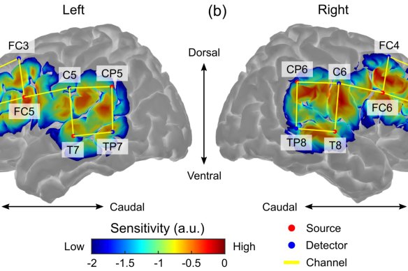 Ishara Paranawithana’s PHD work mapped infant brains to understand how normal hearing develops.