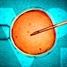 Monash IVF has completed its investigation into two embryo bungles.