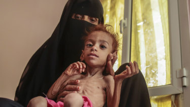 A woman holds her malnourished son in Hajjah, Yemen last month.