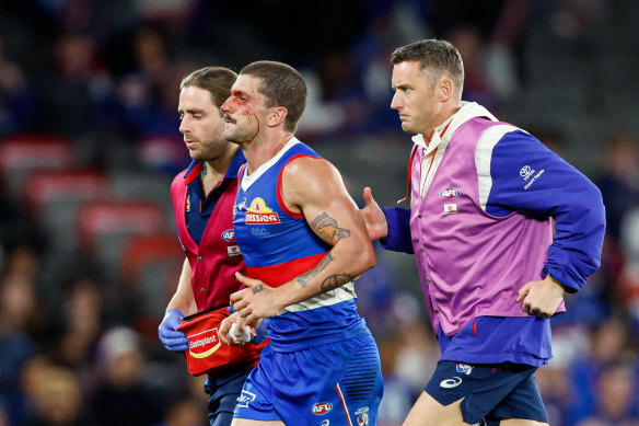 Tom Liberatore leaves the field after copping a stray boot to the face.
