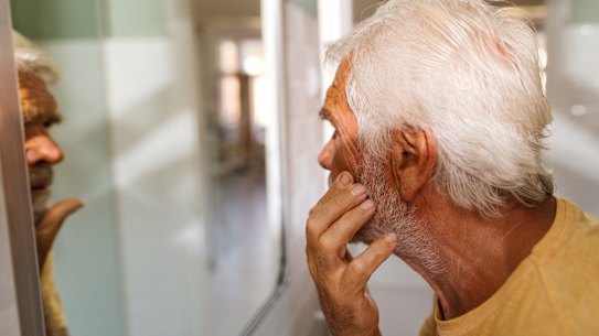 Spider veins aren’t harmful, but many people still want to get rid of them.