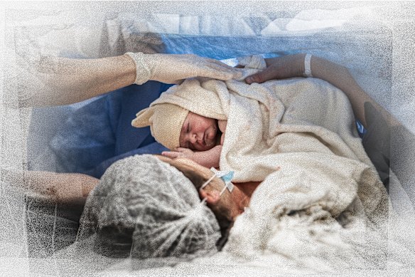 Forty-one per cent of Australian mothers now give birth by caesarean section.