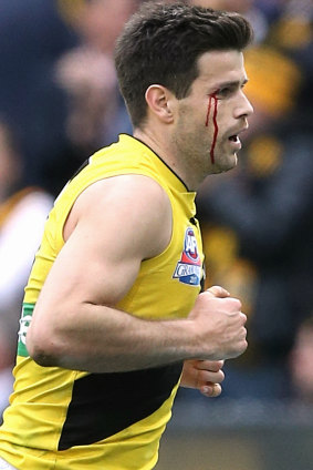 Wounded warrior: Cotchin in the grand final.