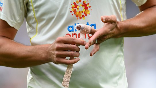 Mitch Starc’s injured finger.