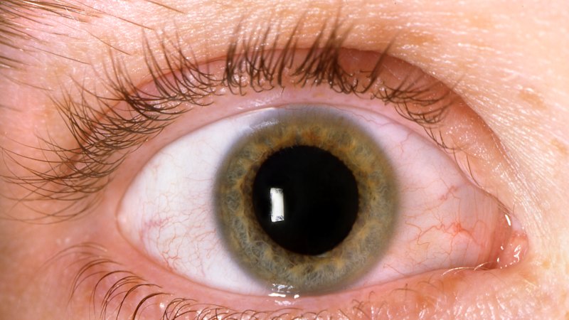 10 things your eyes can tell you about your health (before you feel sick)