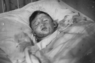Hindenberg disaster survivor Werner Doehner lies in a hospital bed.