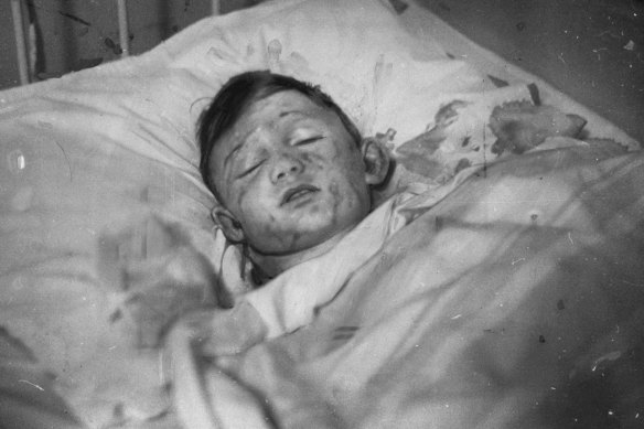 Hindenberg disaster survivor Werner Doehner lies in a hospital bed.