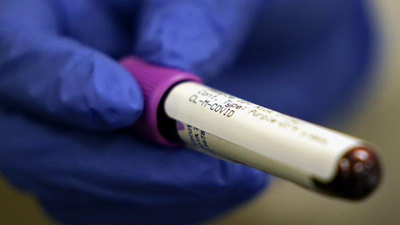 Coronavirus Europe To Boost Covid 19 Testing With Tens Of Million Of Antibody Tests