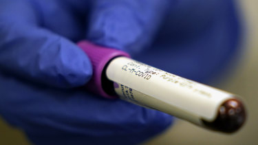 Ramped-up testing for antibodies will produce better information about how widely COVID-19 has spread in the community.