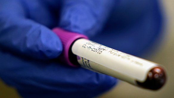 Antibody testing theoretically can tell if a person has previously been infected with a virus, as antibodies remain in the blood for many months after a person recovers from the infection.