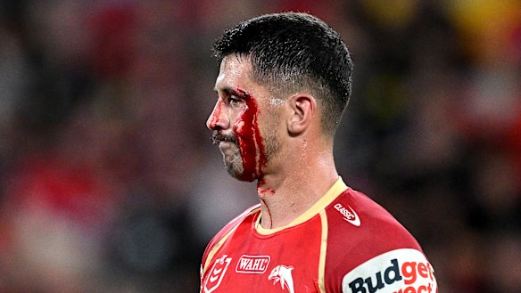 Dolphin Jeremy Marshall-King has been in the wars since arriving in Redcliffe.