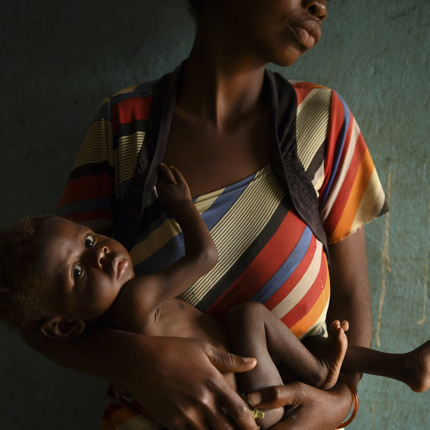 Bilonda Nkashama holds her malnourished son Betu, 10 months old and weighing 4 kilos, as they wait to see a doctor at the Moyo Health Centre in Kasai region. UNICEF says one in seven children dies before reaching the age of five.