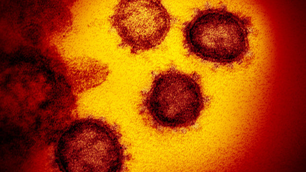 A microscopic virus with protein spikes that is convulsing Australian and global governments. 