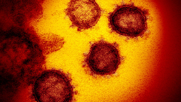 The Novel Coronavirus SARS-CoV-2 also known as 2019-nCoV, the virus that causes COVID-19. 
