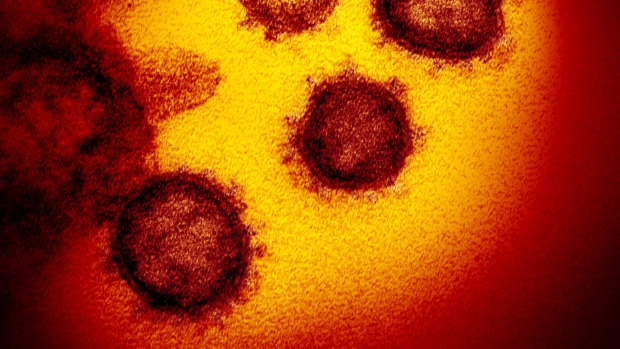 A microscope image of the virus that causes COVID-19.