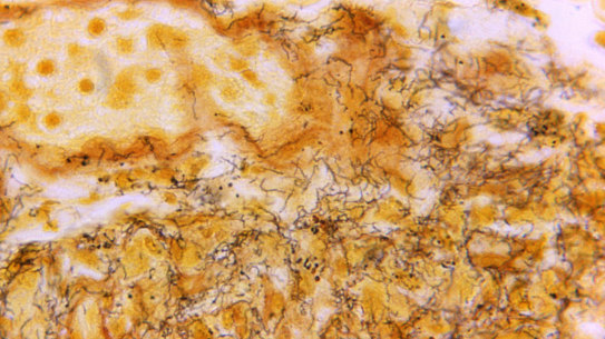 Sexual health physicians want PCR testing for syphilis to be used widely to help contain a growing epidemic of disease in Melbourne.