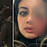 Hannah Thomas, a former Greens candidate, suffered a serious injury to her eye after police broke up a protest in Sydney’s south-west on Friday.