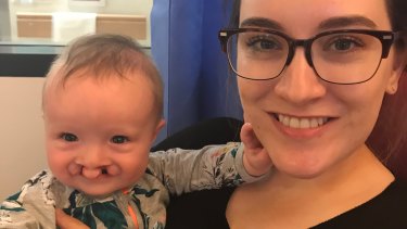 Baby Riley and his mother Rhiannon Bell the morning of Riley's surgery to repair his cleft lip.