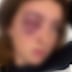 Sam was the victim of a horrific attack on a bus in NSW.
