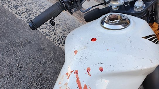 The bike Mohammed's friend was driving when he was punched in the face.