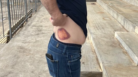 Melbourne Cup favourite Vauban bit his travelling foreman David Casey.