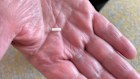 450 patients around the world have had a small electrode, which is  the size of a cooked grain of rice, implanted in their left ventricle.
