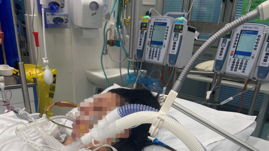 Marie in ICU at St Vincent’s Hospital hours after a cosmetic surgery procedure. 
