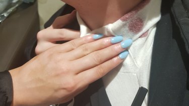 Young Liberal charged with glassing factional opponent