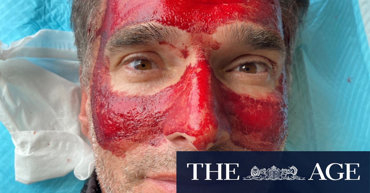 Leech facials, eating dirt and Gwyneth Paltrow: Todd Sampson’s quest for wellness