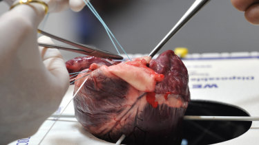Students operate on a pig's heart during a heart surgery workshop in Germany.