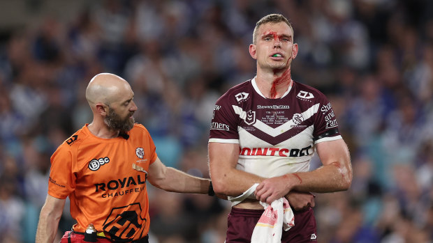 Tom Trbojevic leaves the field after suffering a serious shoulder injury against the Bulldogs in round 26, the latest in a long line of problems for the star fullback.