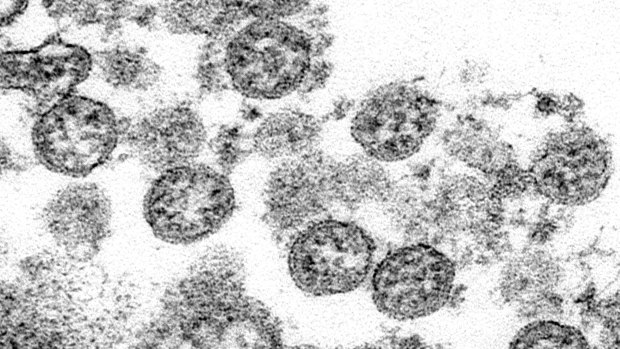 Image of coronavirus particles from what was believed to be the first US case of COVID-19. A new analysis suggests the coronavirus popped up in the US in December 2019, weeks before cases were first recognised by health officials. 