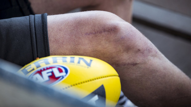 Johnson has had six knee reconstructions and was told he might never play footy again. But he's now back on the field. 