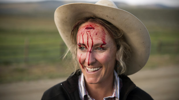 Caitlyn Taussig after a cow kicked a gate, splitting open her forehead, on the family ranch in Kremmling, Colorado. She helps run the ranch with a cadre of cowgirls, including her mother and sister. 