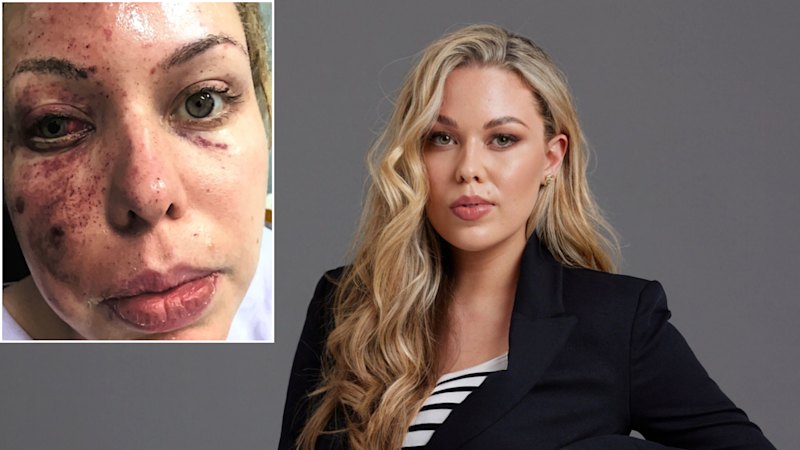 The former beauty queen and gangland girlfriend on her second chance