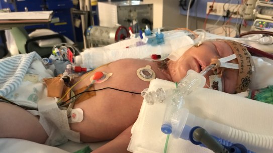 Photo shows baby Jasper hooked up to an ECMO machine which saved his life in May 2017 at Sydney Children's Hospital in Randwick. Photo supplied.