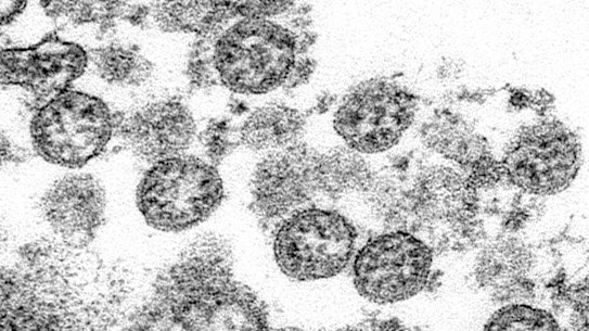 Image of coronavirus particles from what was believed to be the first US case of COVID-19. A new analysis suggests the coronavirus popped up in the US in December 2019, weeks before cases were first recognised by health officials. 