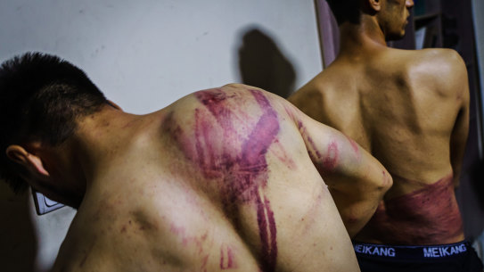 Journalists from the Etilaatroz newspaper, Nemat Naqdi, 28, a video journalist, left and Taqi Daryabi, 22, video editor, undress to show wounds sustained after Taliban fighters tortured and beat them while in custody, after they were arrested for reporting on a women’s rights protest in Kabul.