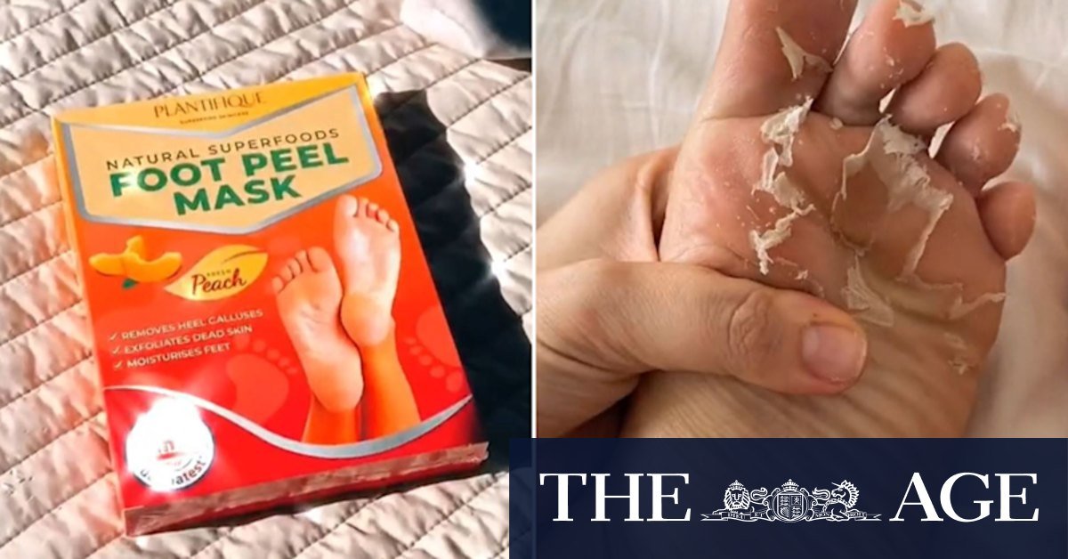 What experts want you to know about those viral foot masks - Vimarsana News