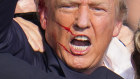 Donald Trump’s political resurrection was boosted by a miraculous-seeming escape from an assassin’s bullet.