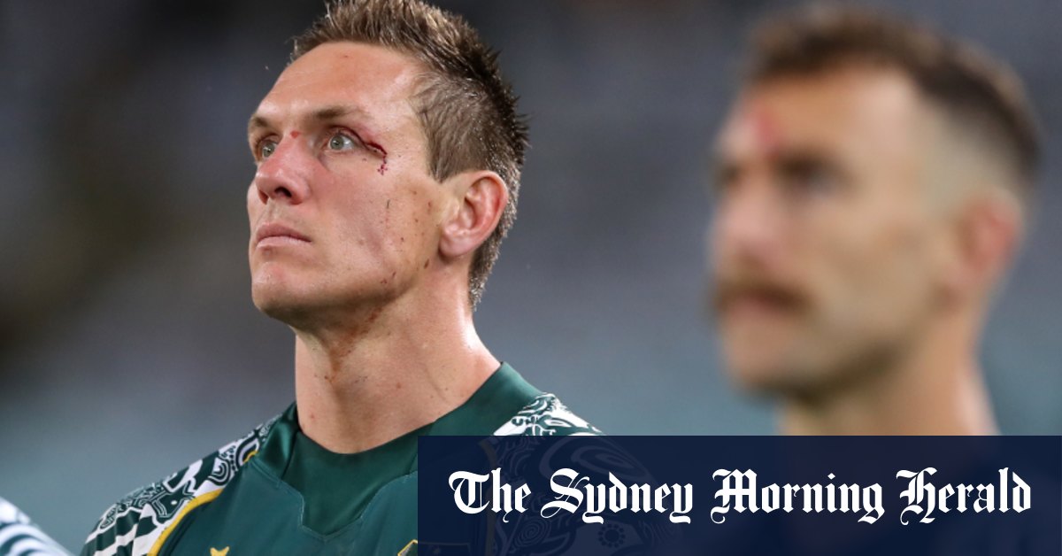 Concussion forces Haylett-Petty to retire