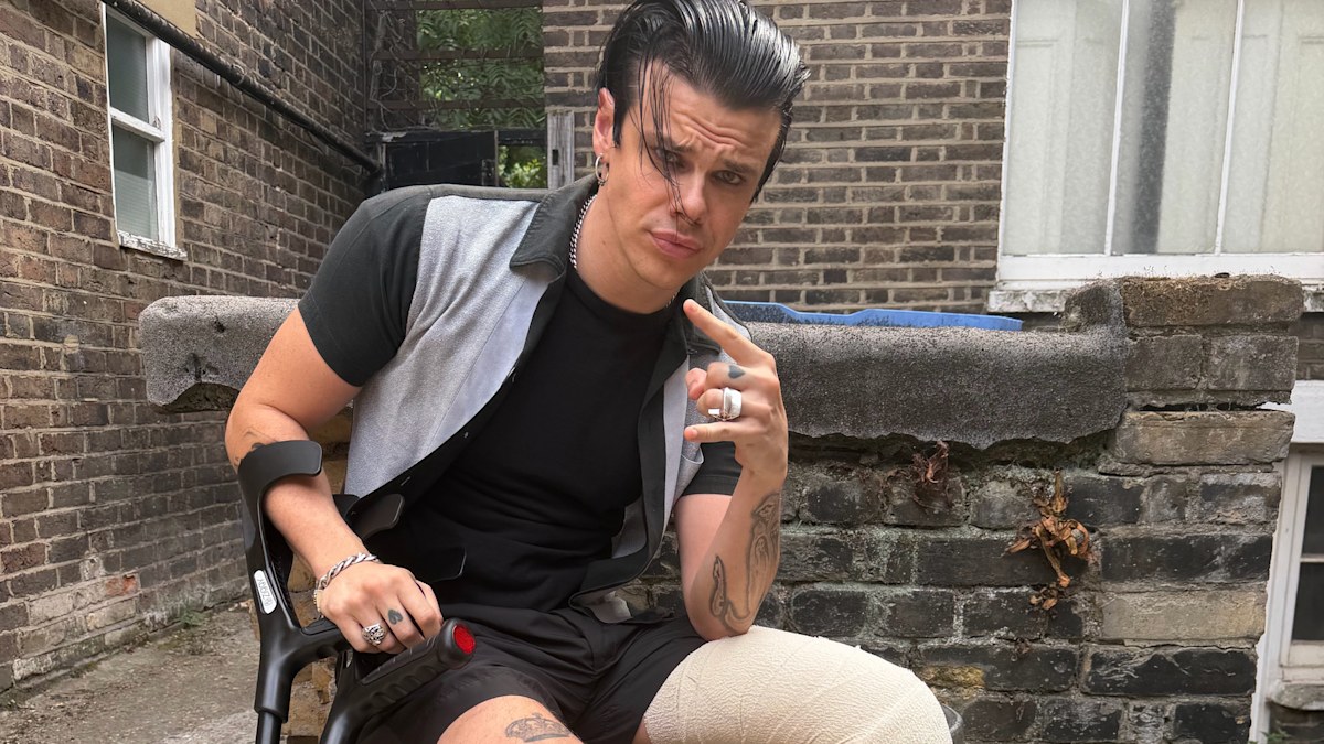 Yungblud: Singer to continue tour after dirt bike injury | Nine.com.au