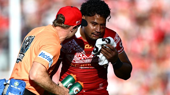 Eli Katoa’s career is under a cloud after suffering a spate of head knocks playing for Tonga last month.
