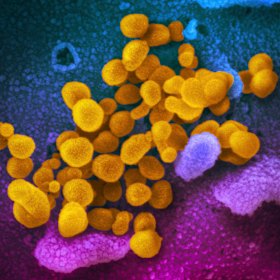 COVID-19: know your enemy.