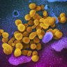 This undated, colourised electron microscope image shows the Coronavirus SARS-CoV-2.