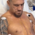 Sonny Bill Williams after surgery.