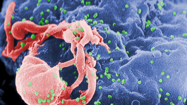 First woman reported cured of HIV after high-risk transplant